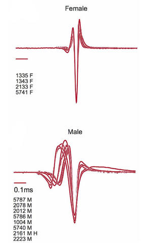 Electric organ discharge waveforms of Stomatorhinus ivindoensis